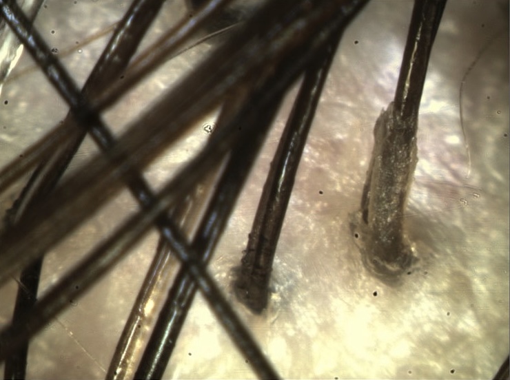 microcamera per capelli