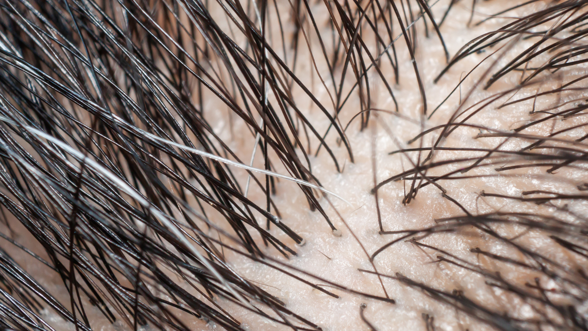 microcamera per capelli