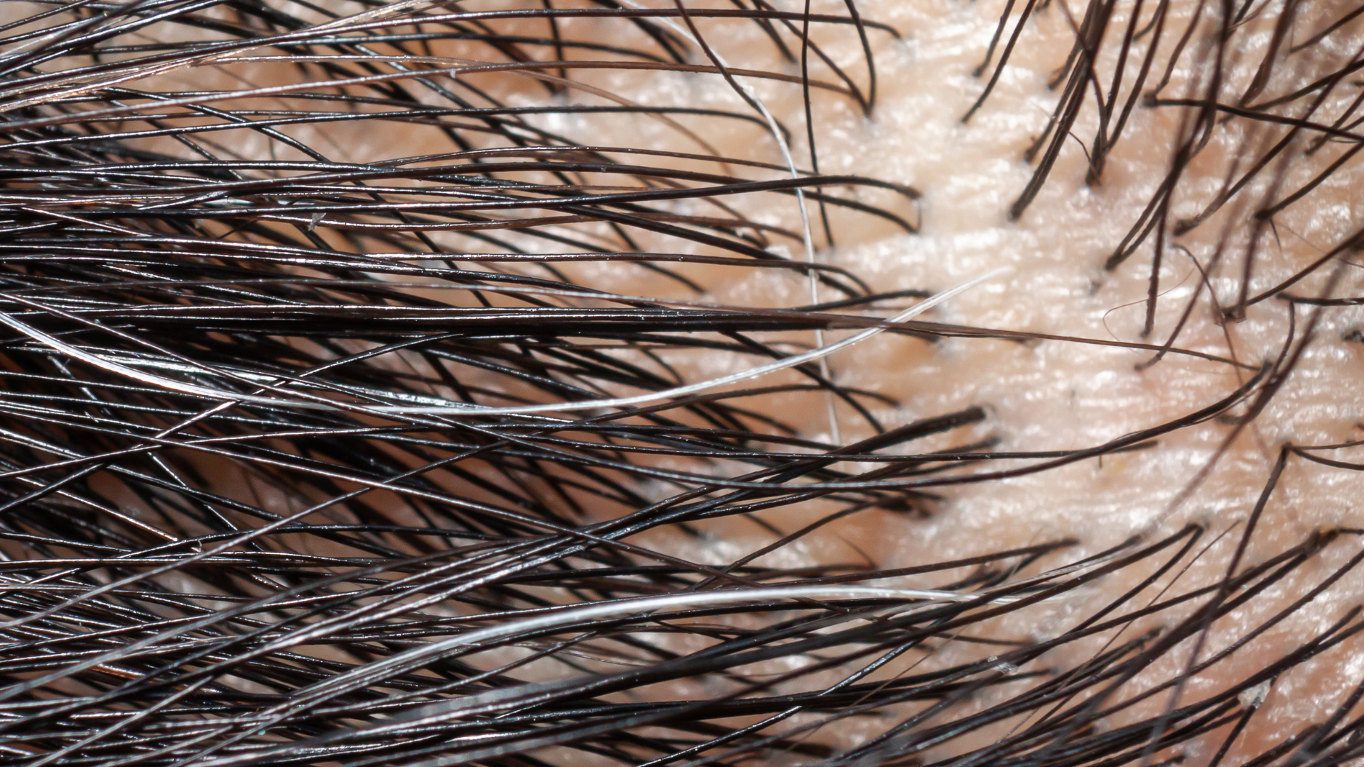 microcamera per capelli